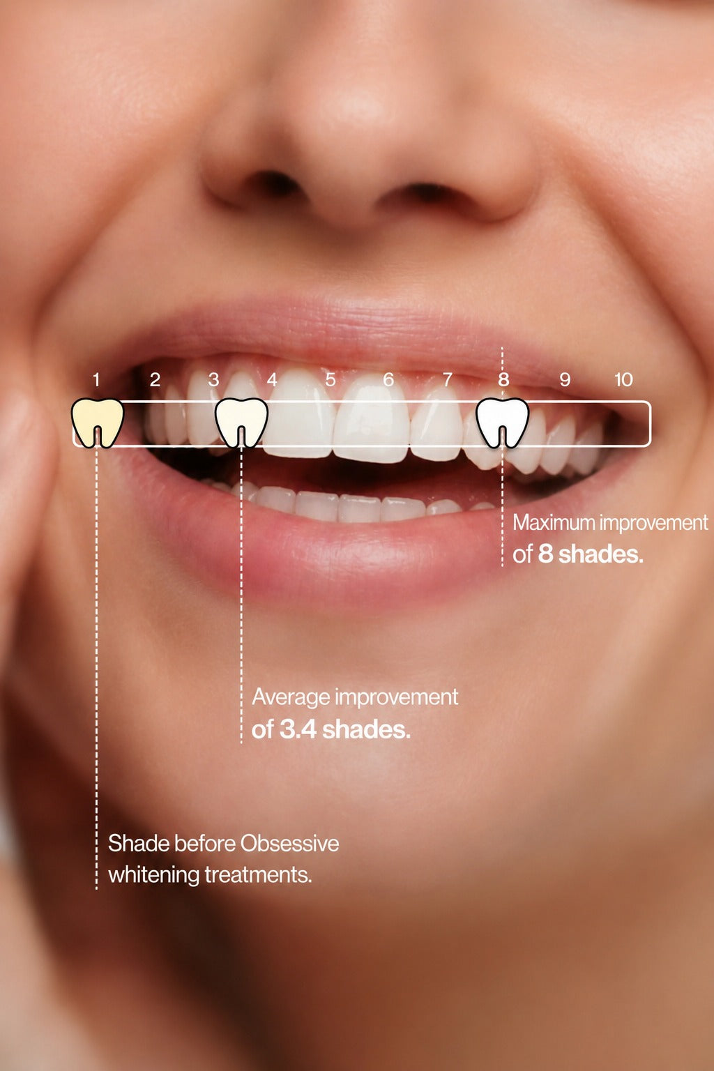 Teeth Whitening Gel - PURPLE V34